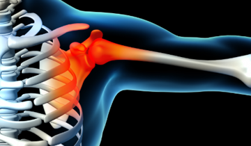 shoulder-pain-injuries